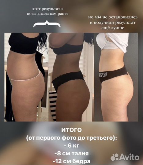 Массаж аппаратный. EMS sculpt