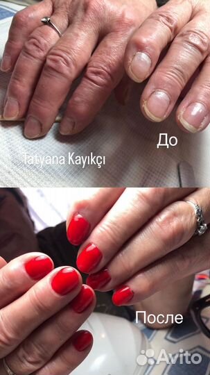 Наращивание