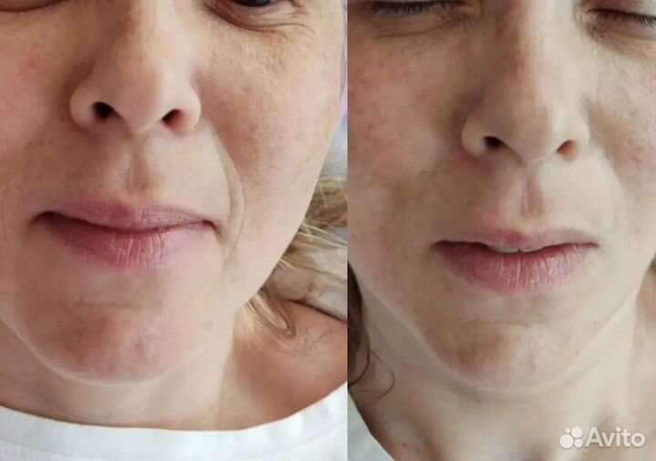 Маска для лица