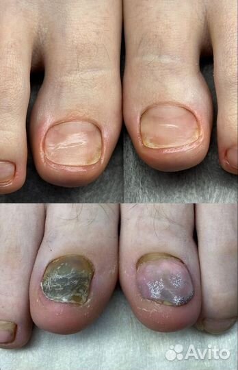 Обучение подологии, педикюру и маникюру