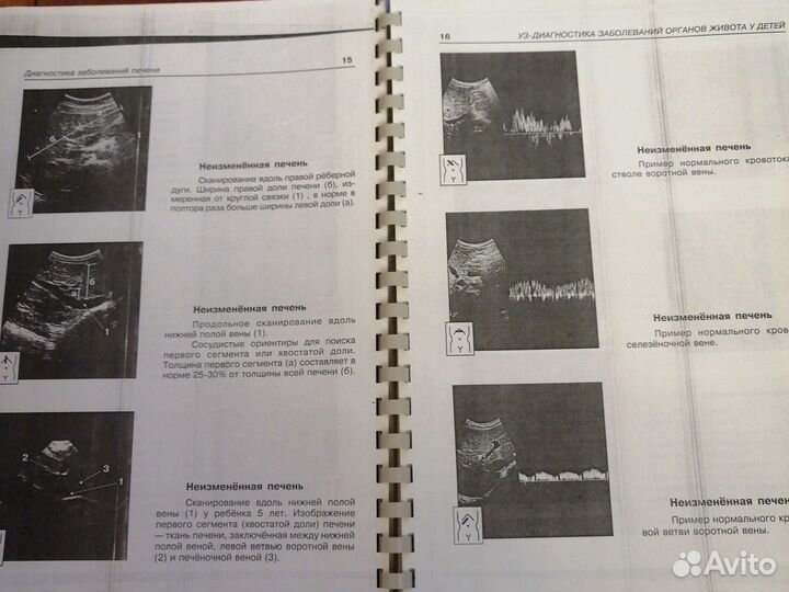 Узд диагностика заболеваний органов живота У детей