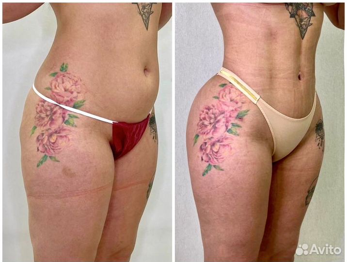 Модели на Худую талию/ Минус 10 кг