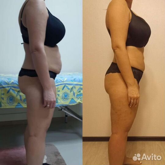 Программа похудения за 10 дней