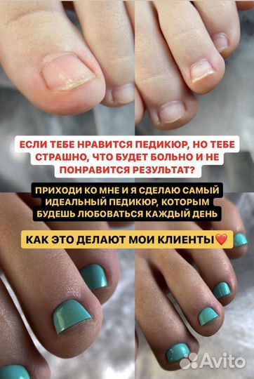 Модель на скоростной маникюр/педикюр без боли
