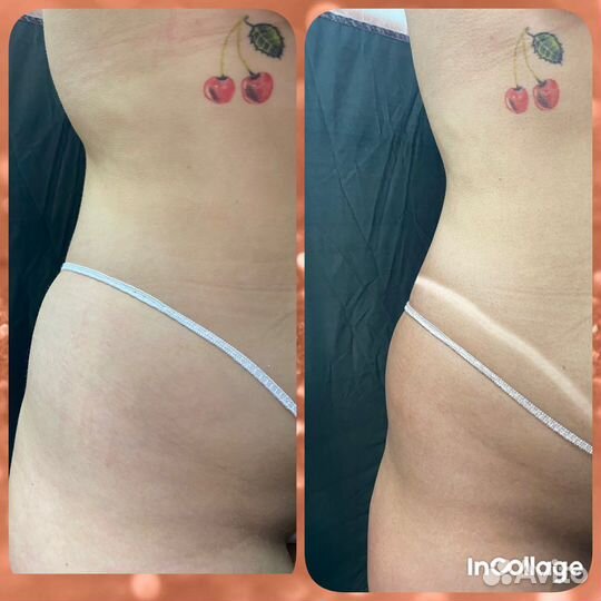 Моментальный загар