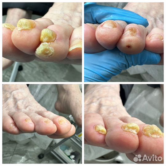 Услуги подолога