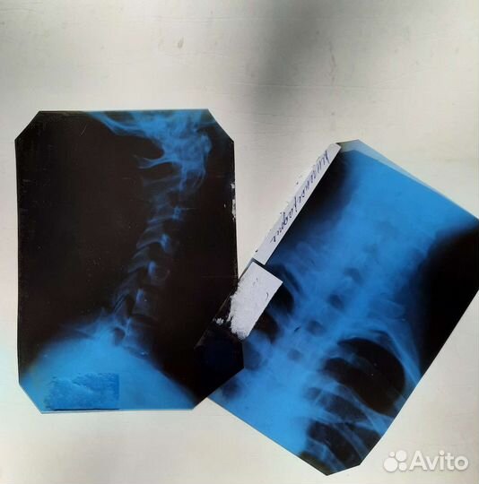 Рентгеновская пленка (снимок) формат А5