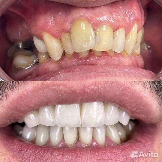 Зубной техник