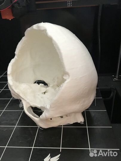 Перелом ребер. Череп. Пластиковая модель