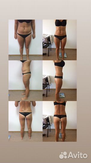 Аппаратная коррекция фигуры