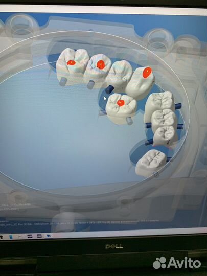 3d фрезеровка Зубов из циркония