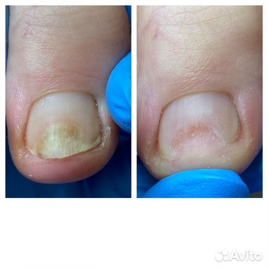 Услуги подолога