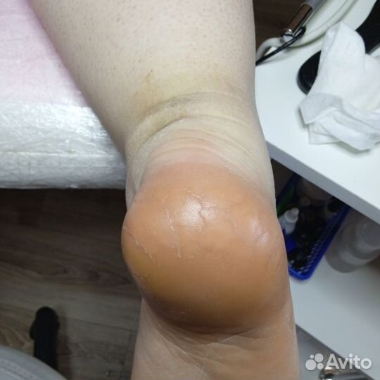 Подолог, мастер педикюра