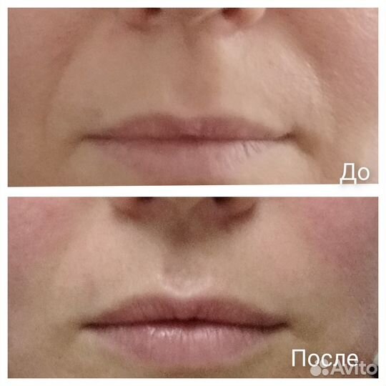 Массаж лица