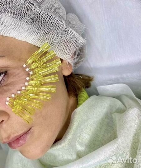 Увеличение губ