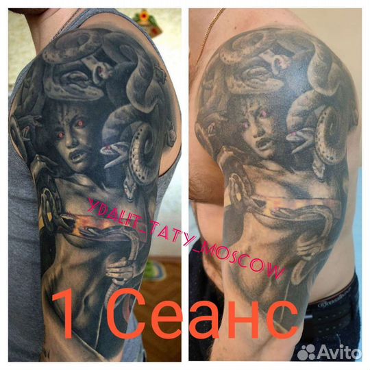 Удаление тату,Татуаж,пилинг,удалить татуировку