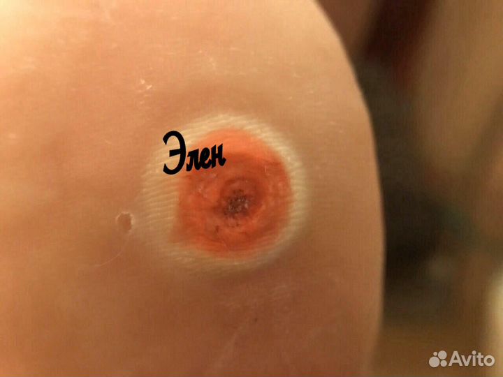 Пластырь от бородавок