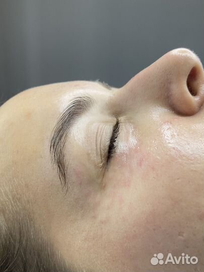 Услуги косметолога