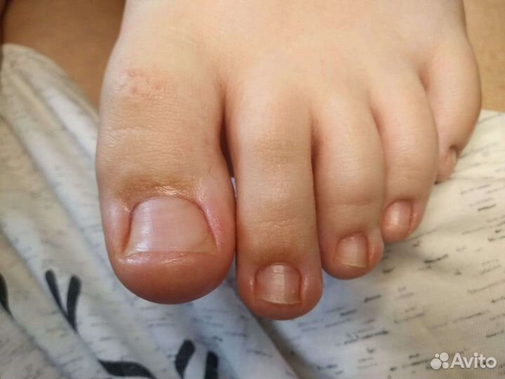 Педикюр-Подолог Славянка