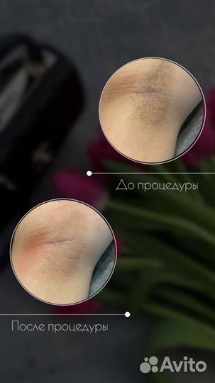 Шугаринг Ваксинг