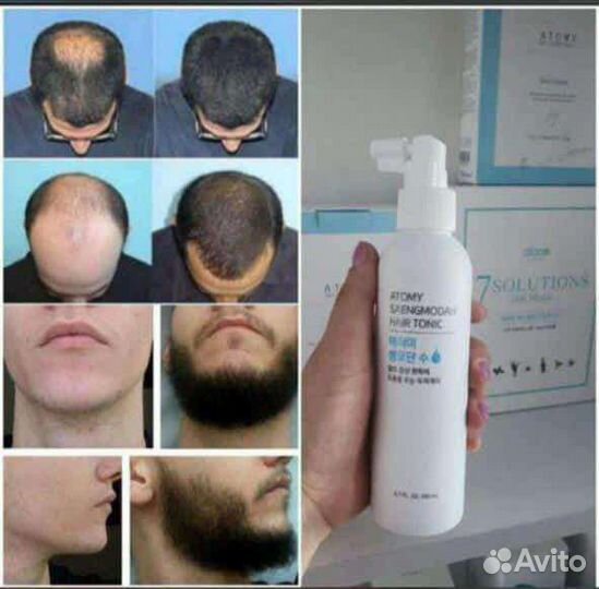 Спрей от выпадения волос