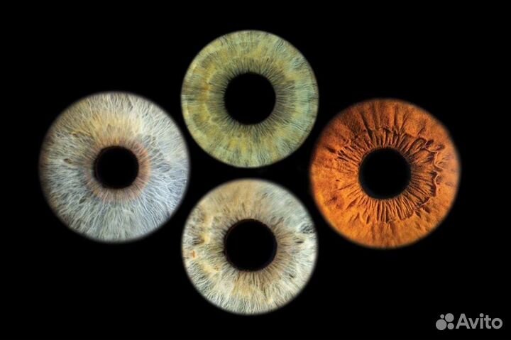 Фото радужки глаза