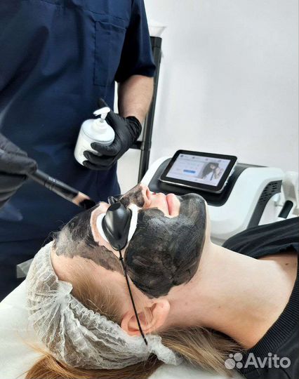 Карбоновый пилинг