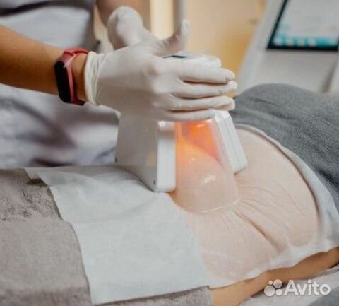 Криолиполиз. Эффективно уменьшает жир на животе