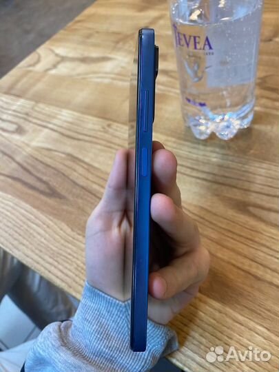 Redmi note 11 pro 5g