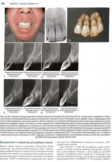 Книга Эндодонтия
