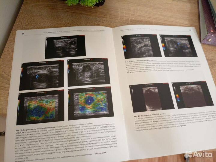 Классификация BI-rads молочной железы