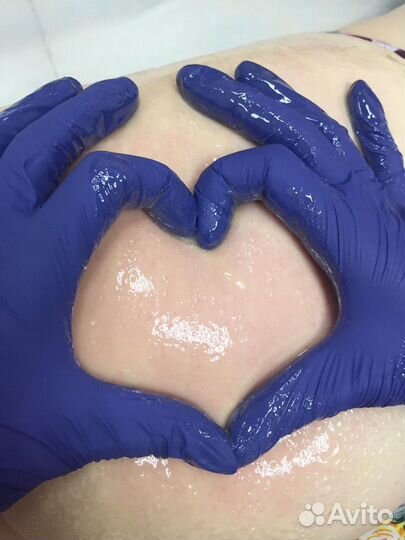 Карамельная липосакция