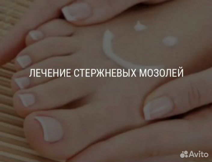 Удаление стержневых мозолей