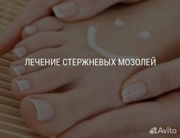 Удаление стержневых мозолей