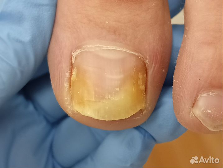 Услуги подолога