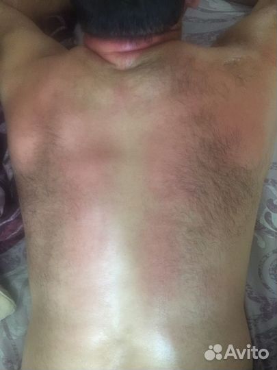 Массаж лица