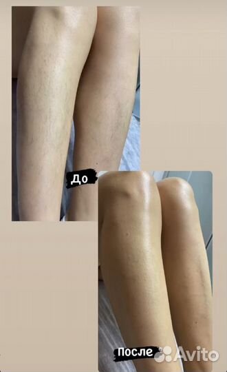 Шугаринг: глубокое бикини