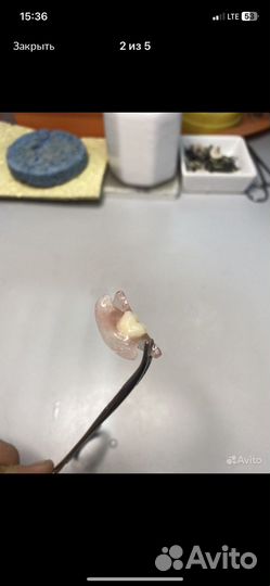 Зубные протезы