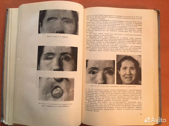 Книги по офтальмологии СССР