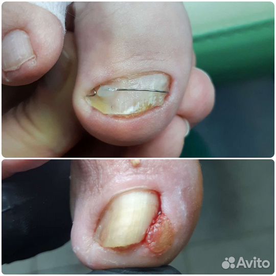 Подолог. Педикюр. Маникюр