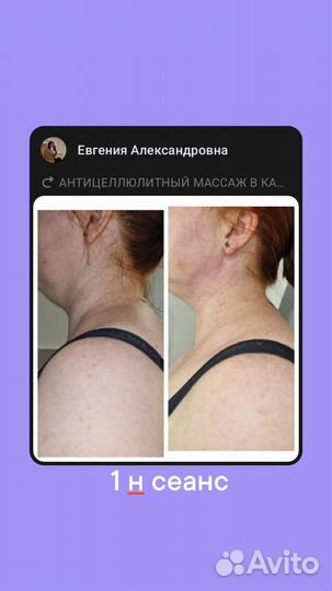 Миофасциальный массаж тела по Татьяне Шубиной