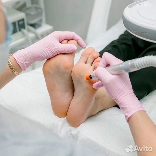 Услуги подолога, вросший ноготь