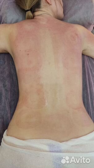 Вакуумно-роликовый аппаратный массаж Starvac