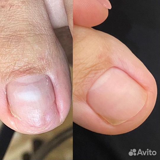 Аппаратный маникюр