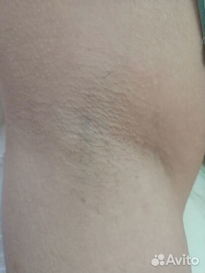 Шугаринг депиляция