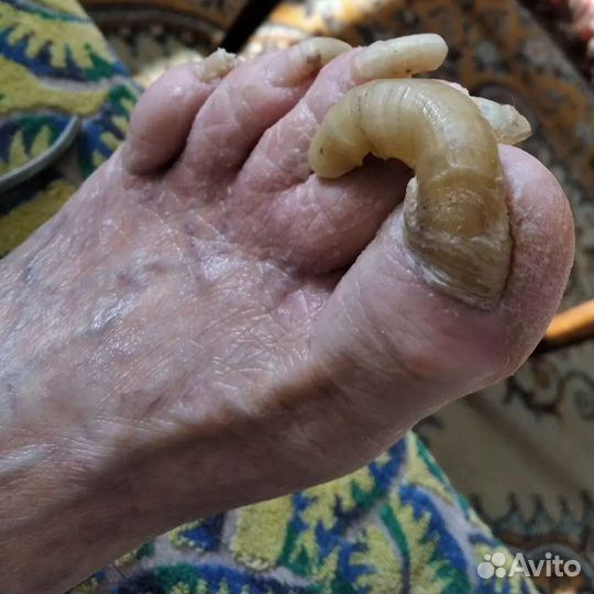 Педикюр(подолог)