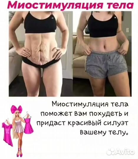 Миостимуляция тела