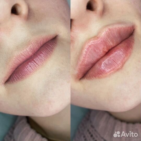 Обучение косметологов