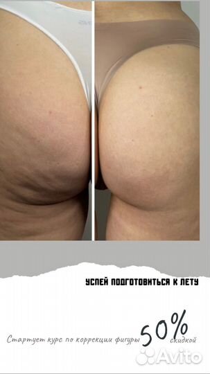 Массаж коррекция фигуры