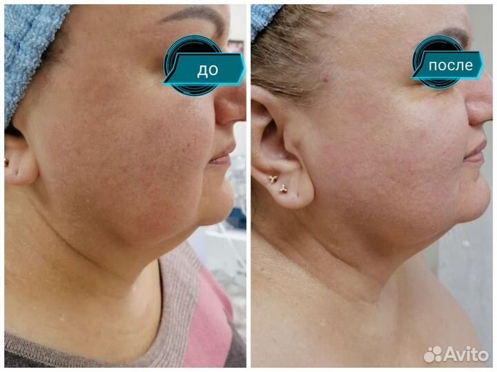 Косметология,коррекция фигуры